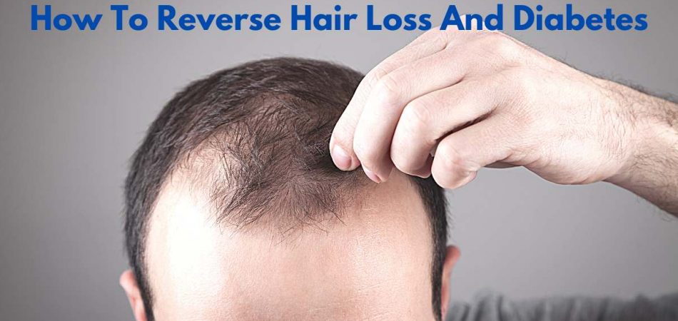 How To Reverse Hair Loss And Diabetes
