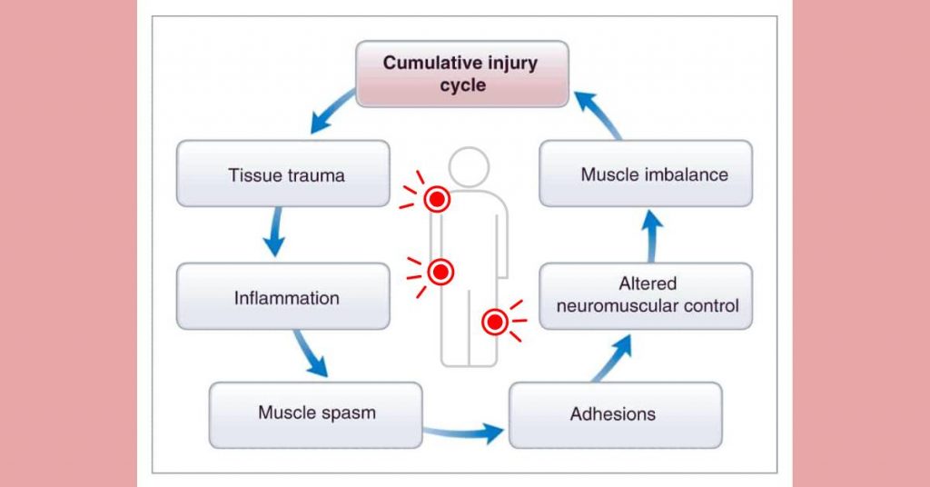 What Are The Steps In The Cumulative Injury Cycle