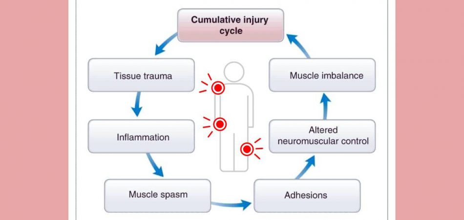 What Are The Steps In The Cumulative Injury Cycle