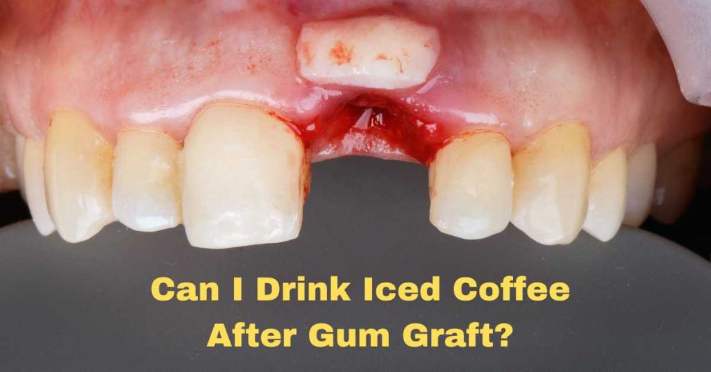 Can I Drink Iced Coffee After Gum Graft?