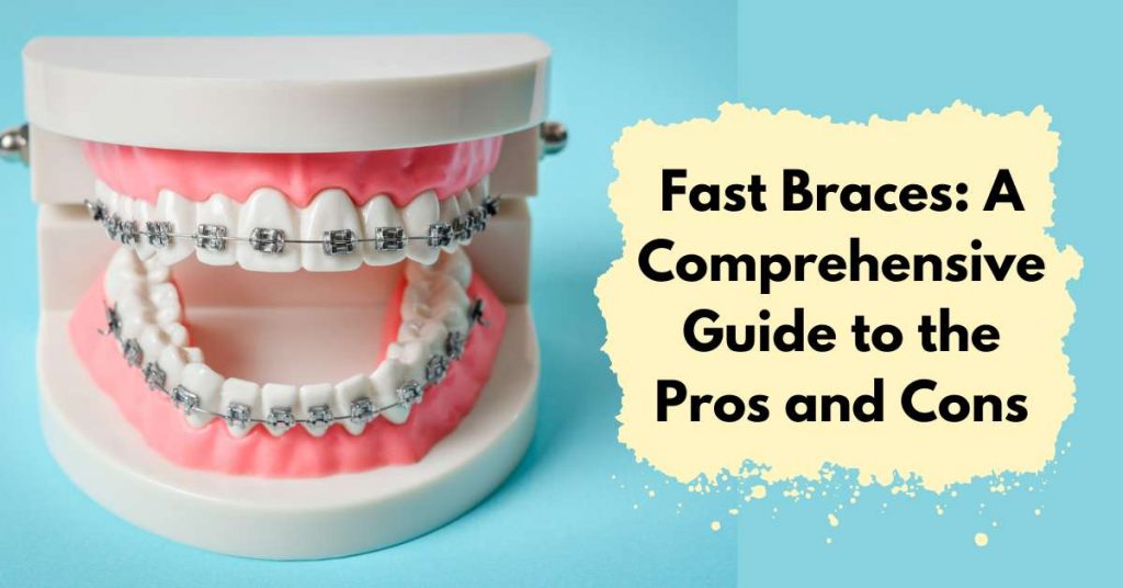 Fast Braces Pros And Cons