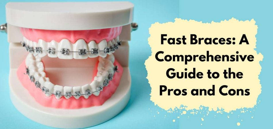 Fast Braces Pros And Cons