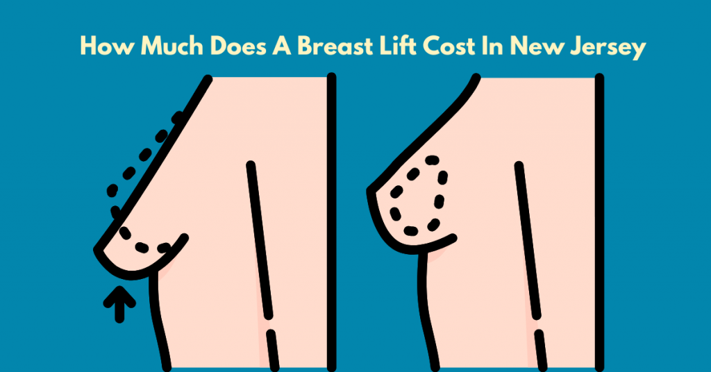 How Much Does A Breast Lift Cost In NJ?